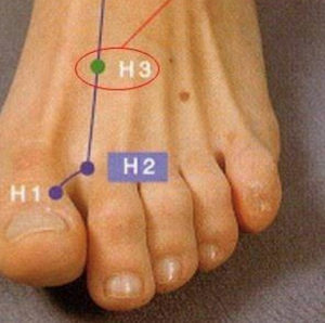 problemi delle infradito nella sfera sessuale